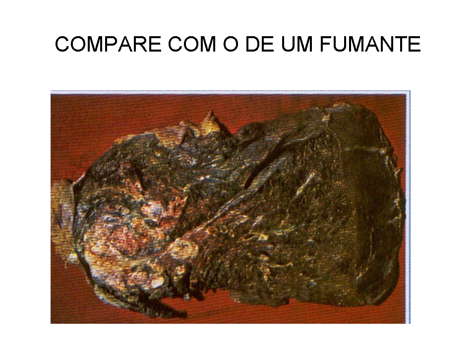 Como deixar de fumar o vídeo e o livro